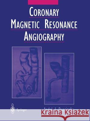 Coronary Magnetic Resonance Angiography Andre J. Duerinckx A. E. Stillman 9781475776928 Springer