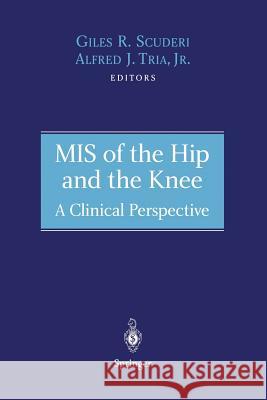 MIS of the Hip and the Knee: A Clinical Perspective Scuderi, Giles R. 9781475780406