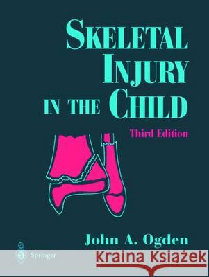 Skeletal Injury in the Child Ogden, John A. 9781475781533