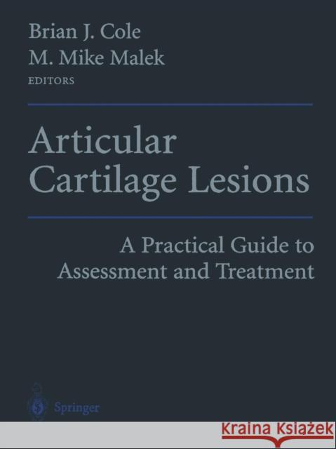 Articular Cartilage Lesions: A Practical Guide to Assessment and Treatment Cole, Brian J. 9781475792898