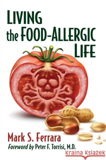 Living the Food-Allergic Life Mark S. Ferrara 9781476691435 Toplight Books