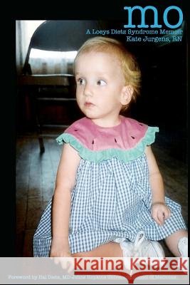Mo A Loeys Dietz Syndrome Memoir Dietz MD, Hal 9781477584750