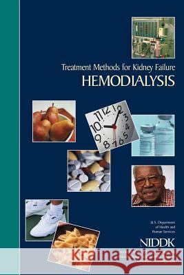 Treatment Methods for Kidney Failure: Hemodialysis U. S. Department of Heal Huma National Institutes of Health National Institute An 9781478297321 Createspace