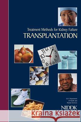 Treatment Methods for Kidney Failure: Transplantation U. S. Department of Heal Huma National Institutes of Health National Institute of D Kidne 9781478297451 Createspace