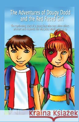 The Adventures of Dougy Dodd and the Red Faced Girl: The Continuing Story of a Young Boy Who Sees When Others Are Hurt and Responds the Way Jesus Woul Rebecca E. Burns 9781478731610 Outskirts Press