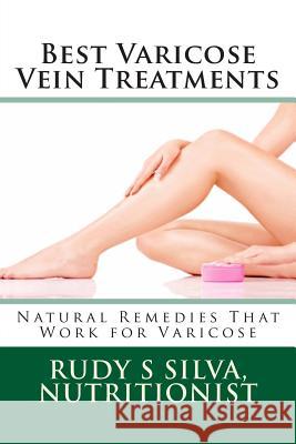 Best Varicose Vein Treatments: Natural Remedies That Work for Varicose Rudy Silva Silva 9781481955836 Createspace