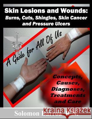 Skin Lesions and Wounds: Burns, Cuts, Shingles, Skin Cancer and Pressure Ulcer: ( Concepts, Causes, Diagnoses, Treatment and Care ) Solomon Barroa 9781482080407
