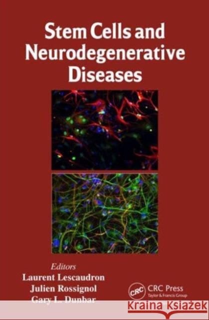 Stem Cells and Neurodegenerative Diseases Laurent Lescaudron Julien Rossignol Gary L. Dunbar 9781482210736