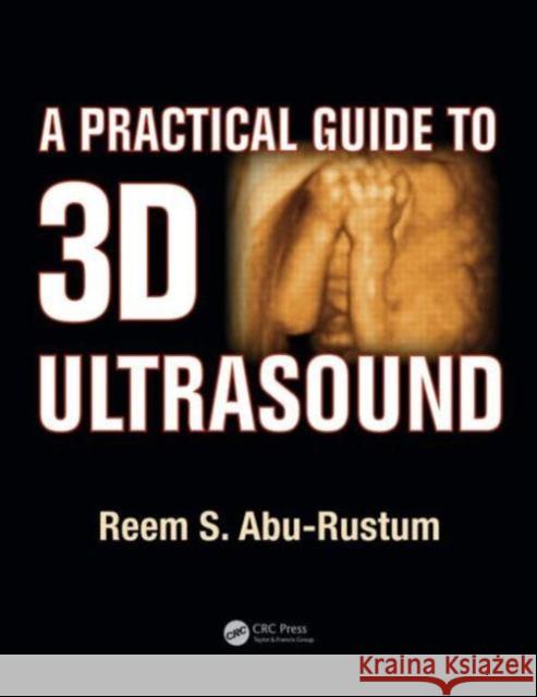 A Practical Guide to 3D Ultrasound Reem S. Abu-Rustum 9781482214338