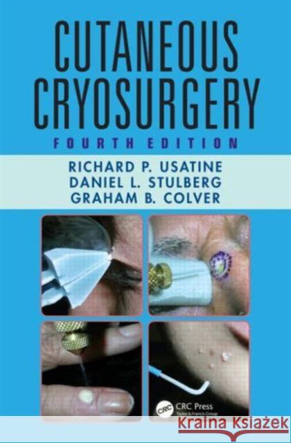 Cutaneous Cryosurgery: Principles and Clinical Practice Usatine, Richard P. 9781482214734 CRC Press