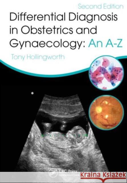 Differential Diagnosis in Obstetrics and Gynaecology: An A-Z: An A-Z, Second Edition Hollingworth, Tony 9781482215298