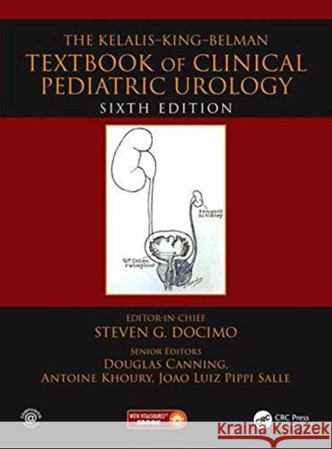 The Kelalis--King--Belman Textbook of Clinical Pediatric Urology: Textbook of Clinical Pediatric Urology Docimo, Steven G. 9781482219470 CRC Press