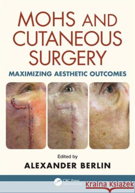 Mohs and Cutaneous Surgery: Maximizing Aesthetic Outcomes Alexander Berlin 9781482221367 CRC Press