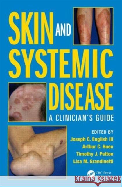 Skin and Systemic Disease: A Clinician's Guide English III, Joseph C. 9781482221589 CRC Press