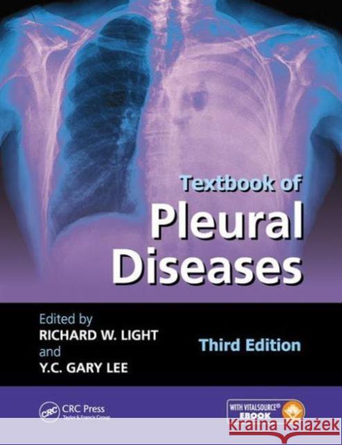 Textbook of Pleural Diseases Richard W. Light Y. C. Gary Lee 9781482222500 CRC Press