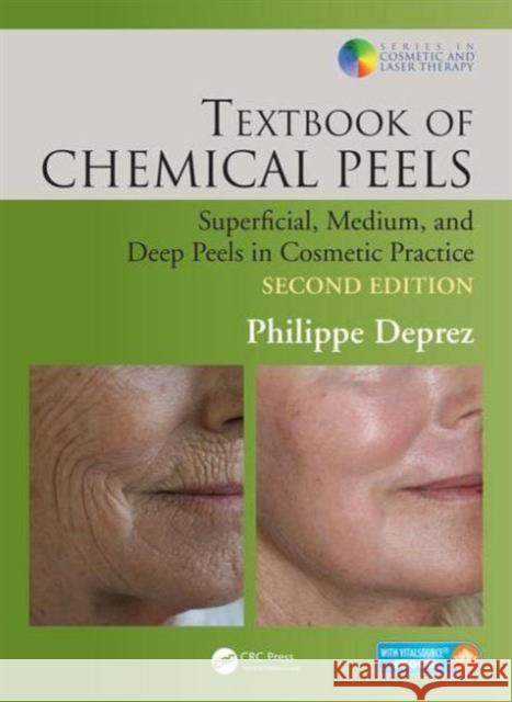 Textbook of Chemical Peels: Superficial, Medium, and Deep Peels in Cosmetic Practice Deprez Philippe 9781482223934 CRC Press