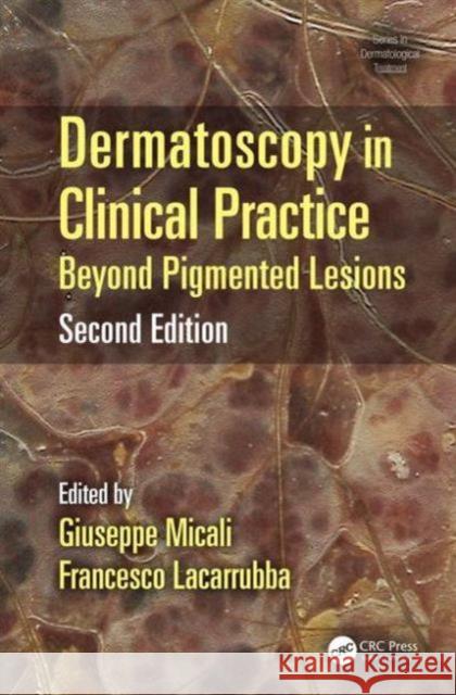 Dermatoscopy in Clinical Practice: Beyond Pigmented Lesions Giuseppe Micali Francesco Lacarrubba 9781482225952 CRC Press