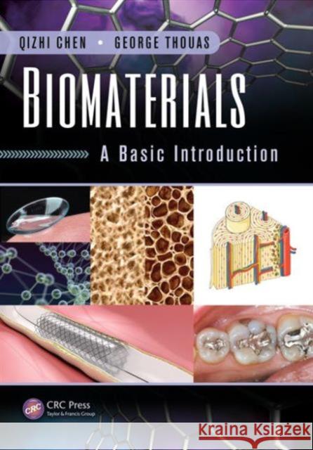 Biomaterials: A Basic Introduction Qizhi Chen 9781482227697