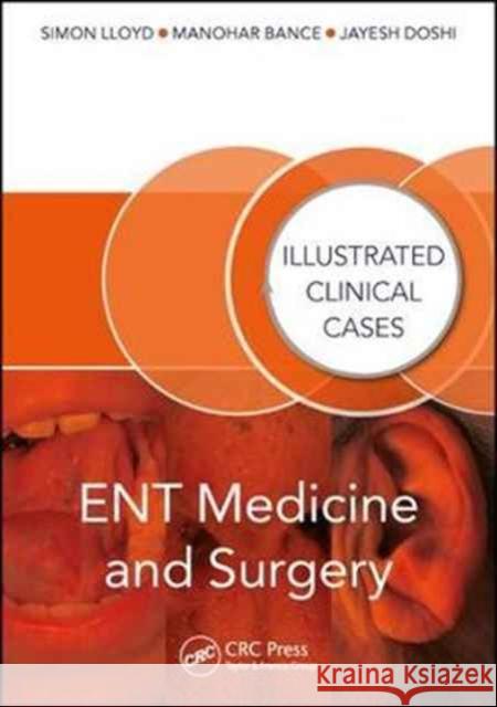 Ent Medicine and Surgery: Illustrated Clinical Cases Simon Lloyd Manohar Bance Jayesh Doshi 9781482230413 CRC Press