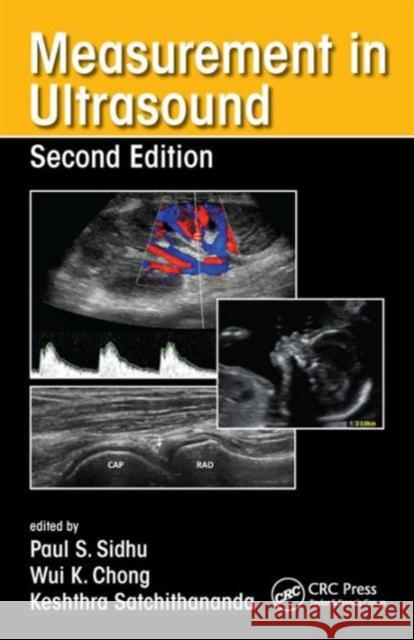 Measurement in Ultrasound Paul Sidhu 9781482231359 Apple Academic Press