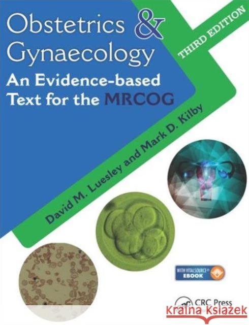 Obstetrics & Gynaecology: An Evidence-Based Text for MRCOG Luesley David M. Kilby Mark D. 9781482233827