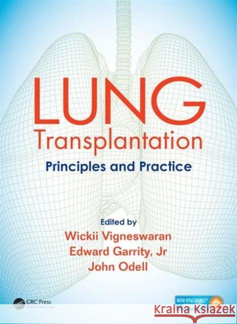 Lung Transplantation: Principles and Practice Wickii Vigneswaran Edward Garrity John Odell 9781482233919 CRC Press