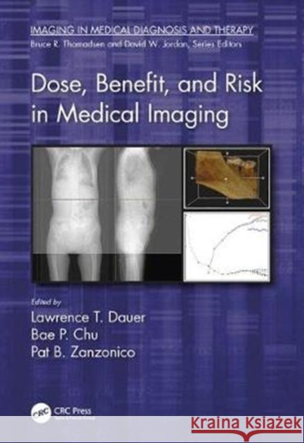 Dose, Benefit, and Risk in Medical Imaging Lawrence T. Dauer Bae P. Chu Pat B. Zanzonico 9781482237542 CRC Press