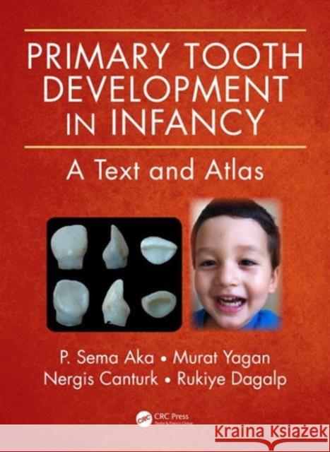 Primary Tooth Development in Infancy: A Text and Atlas P. Sema Aka Murat Yagan Nergis Canturk 9781482238518 CRC Press