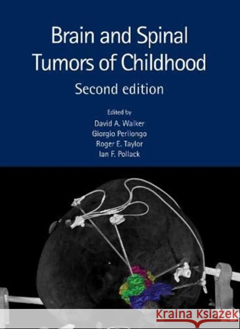 Brain and Spinal Tumors of Childhood Walker, David A. 9781482242775 CRC Press