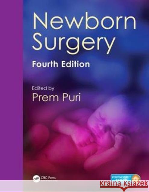 Newborn Surgery Prem Puri 9781482247701 CRC Press