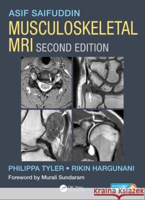Musculoskeletal MRI Saifuddin, Asif 9781482247800 Taylor and Francis