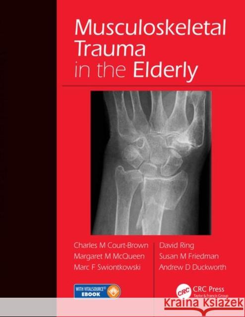 Musculoskeletal Trauma in the Elderly Charles M. Court-Brown 9781482252026 Apple Academic Press