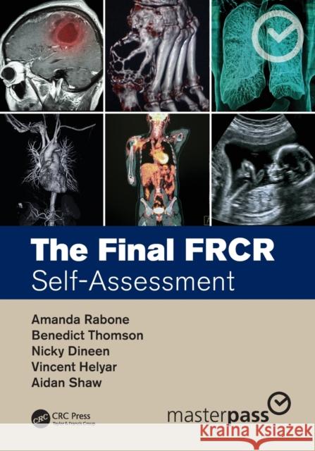 The Final FRCR: Self-Assessment Rabone, Amanda 9781482259742 Apple Academic Press