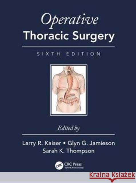 Operative Thoracic Surgery Kaiser, Larry R. 9781482299571 CRC Press