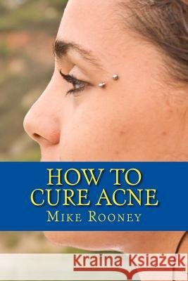 How To Cure Acne: What Is Acne And The Best Treatments For Acne Rooney, Mike 9781482389029 Createspace