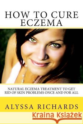 How To Cure Eczema: Natural Eczema Treatment To Get Rid Of Skin Problems Once And For All Richards, Alyssa 9781482738124 Createspace