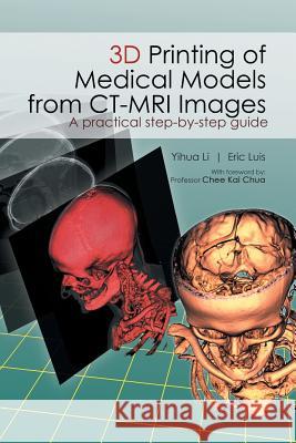 3D Printing of Medical Models from CT-MRI Images: A Practical step-by-step guide Li Yihua 9781482879407