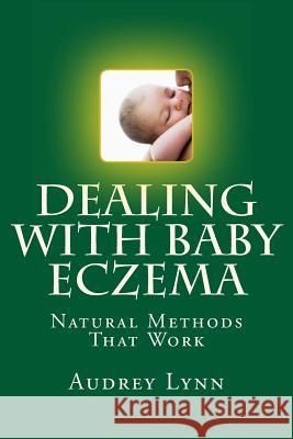 Dealing With Baby Eczema: Natural Methods That Work Lynn, Audrey 9781484844342 Createspace