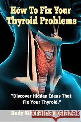 How To Fix Your Thyroid Problems: Discover Hidden Ideas That Fix Your Thyroid Silva, Rudy Silva 9781489546982