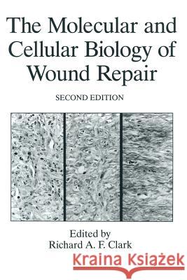 The Molecular and Cellular Biology of Wound Repair Richard Clark R. a. F. Clark 9781489901873 Springer