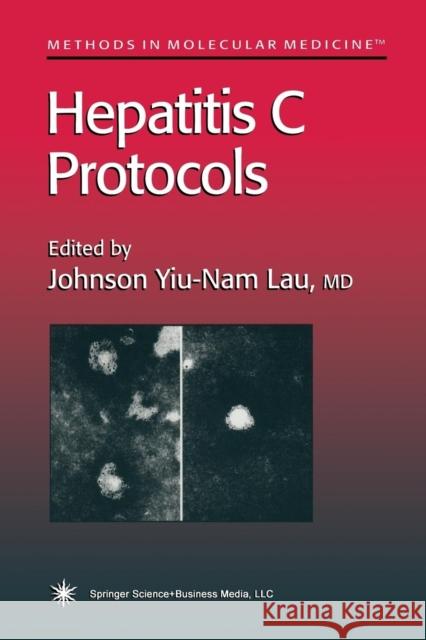 Hepatitis C Protocols Johnson Y. N. Lau 9781489943484 Humana Press