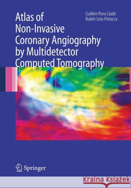 Atlas of Non-Invasive Coronary Angiography by Multidetector Computed Tomography Guillem Pons-Llado Ruben Leta-Petracca 9781489978967 Springer