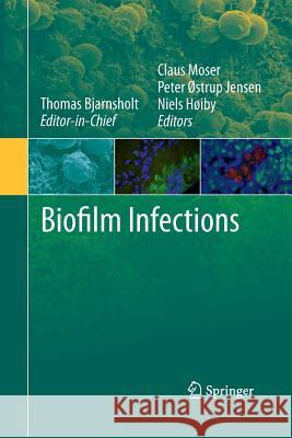 Biofilm Infections Niels Hoiby Peter Ostrup Jensen Sir Claus Moser, Sir 9781489982285 Springer