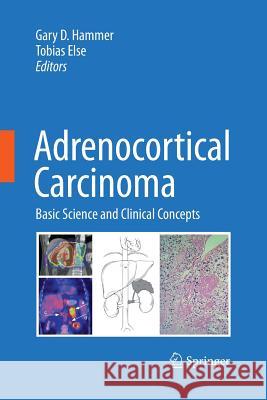 Adrenocortical Carcinoma: Basic Science and Clinical Concepts Hammer, Gary D. 9781489982629