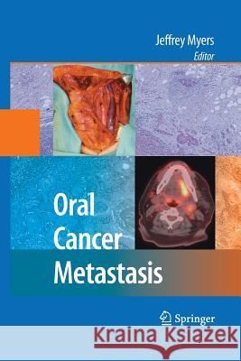 Oral Cancer Metastasis Jeffrey Myers   9781489984760