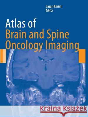 Atlas of Brain and Spine Oncology Imaging Sasan Karimi 9781489992215 Springer