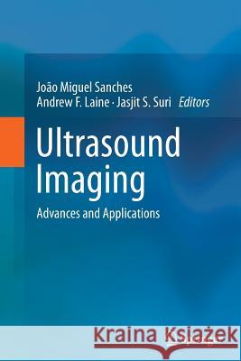 Ultrasound Imaging: Advances and Applications Sanches, Joao Miguel 9781489997937 Springer