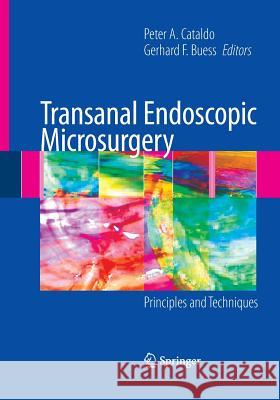 Transanal Endoscopic Microsurgery: Principles and Techniques Cataldo, Peter 9781489998910 Springer