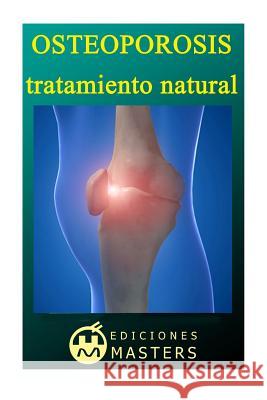 Osteoporosis: Tratamiento natural Agusti, Adolfo Perez 9781492709879