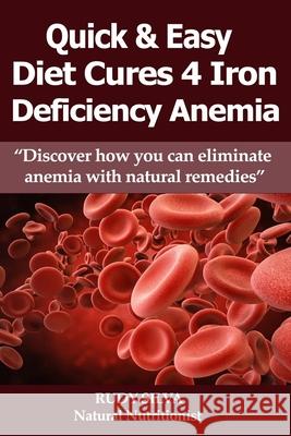 Anemia: Iron Deficiency Diet: Large Print: Quick and Easy Diet Cures For Anemia Silva, Rudy Silva 9781492919896 Createspace